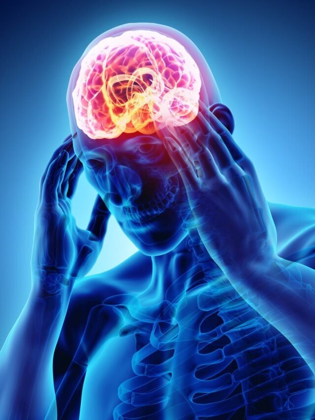11 Migraine Misunderstandings