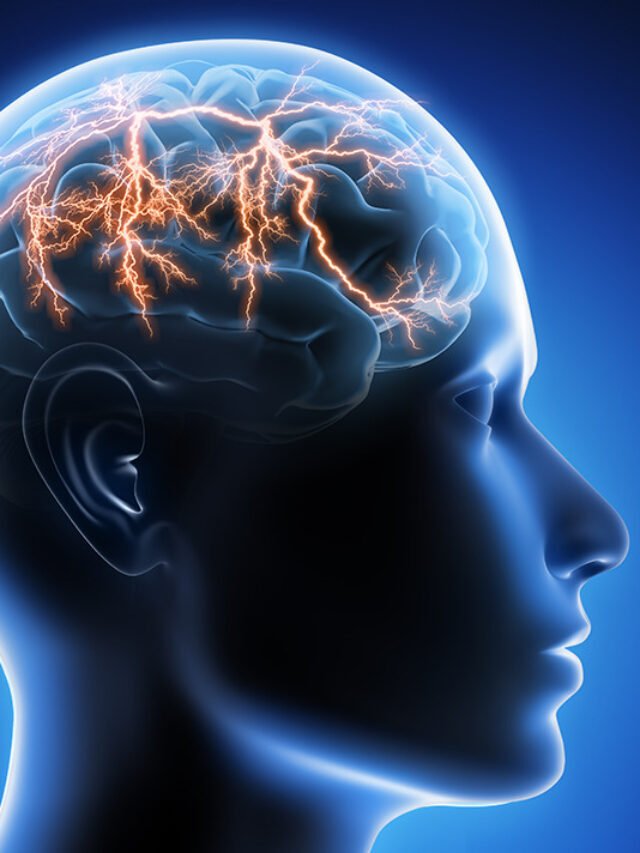Medical Myths: All About Epilepsy