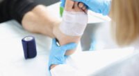 Diabetes & Wound Healing